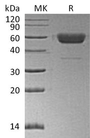 Recombinant Human/Mouse/Rat Irisin (C-Fc)
