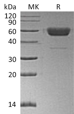 Recombinant Human/Mouse/Rat Irisin (C-Fc)