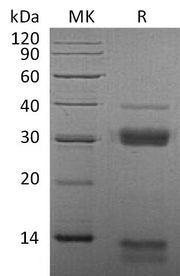 Recombinant Mouse CTSS (C-6His)