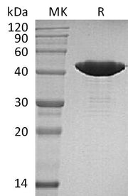 Recombinant Human IDH1 (R132H, C-8His)