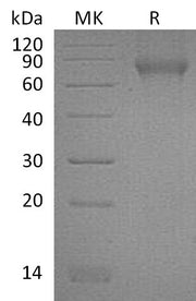 Recombinant Mouse NgR (C-6His)