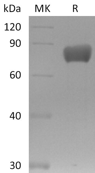 Recombinant Mouse FSTL1 (C-Fc)