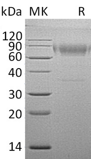 Recombinant Mouse IL-18BPd (C-Fc)
