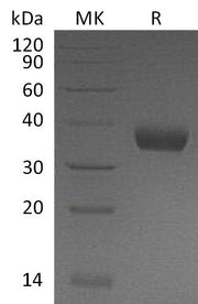 Recombinant Mouse PRLR (C-6His)