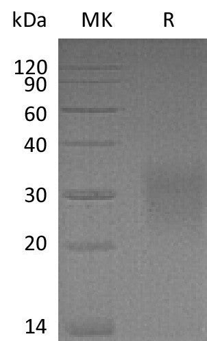 Recombinant Mouse CD83 (C-6His)
