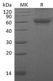 Recombinant Mouse DDR2 (C-6His)