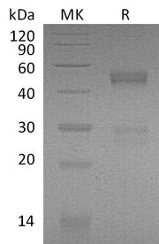 Recombinant Mouse NOV (C-6His)