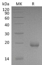 Recombinant Mouse Limitin (C-6His)