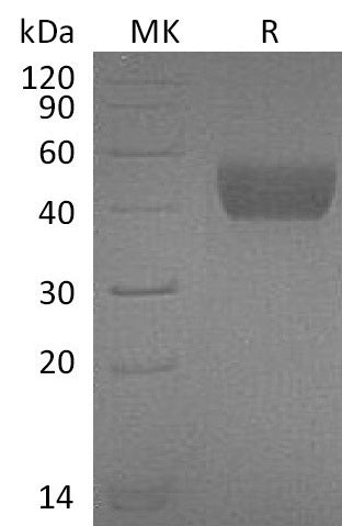 Recombinant Mouse FSTL1 (C-6His)
