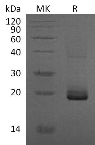 Recombinant Mouse ESM‑1 (C-6His)