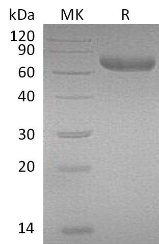 Recombinant Mouse PRLR (C-Fc)