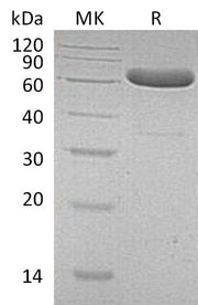 Recombinant Human EpCAM (C-Fc)