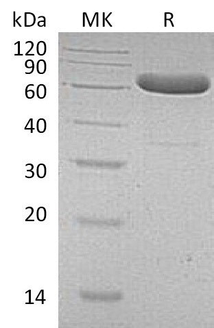 Recombinant Human EpCAM (C-Fc)