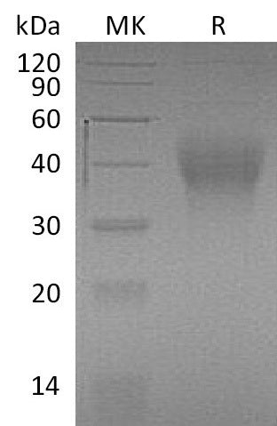 Recombinant Mouse TIM-3 (C-6His)