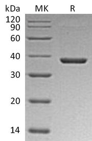 Recombinant Mouse B7-H3 (C-6His)
