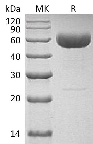 Recombinant Human IL-22 (C-hIgG4 Fc)