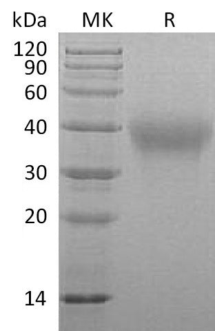 Recombinant Marmoset TIM-3 (C-6His)