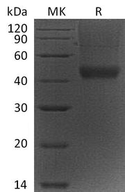 Recombinant Mouse Decorin (C-6His)