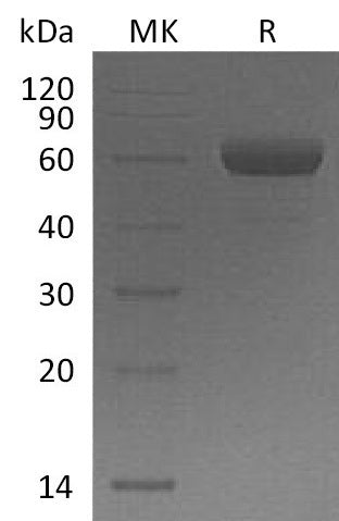 Recombinant Mouse TREM-2b (C-Fc)