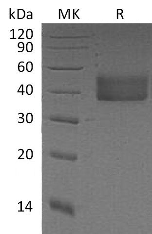 Recombinant Mouse CFD (C-6His)