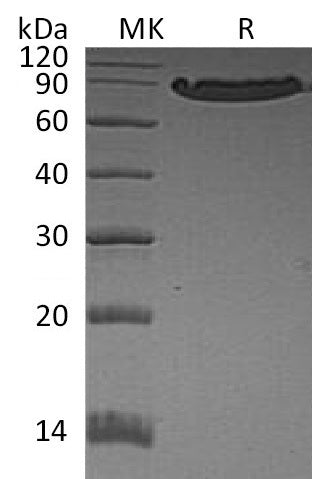 Recombinant Human CDH1 (C-6His)
