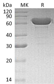 Recombinant Human Albumin