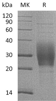 Recombinant Mouse TREM-2b (C-6His)