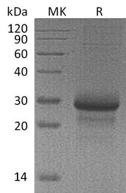 Recombinant Mouse MBL-2