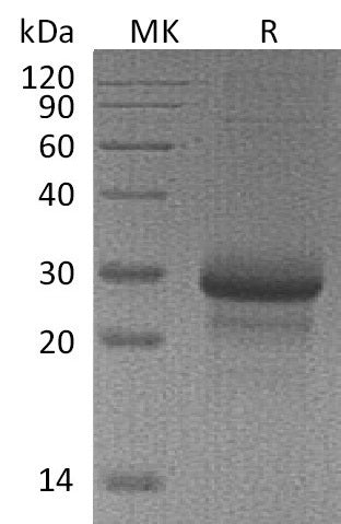 Recombinant Mouse MBL-2