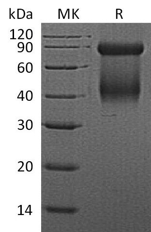 Recombinant Mouse GZMD (C-6His)