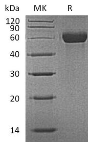 Recombinant Mouse MARCO (N-8His)