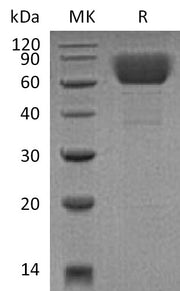 Recombinant Mouse CD39 (C-6His)