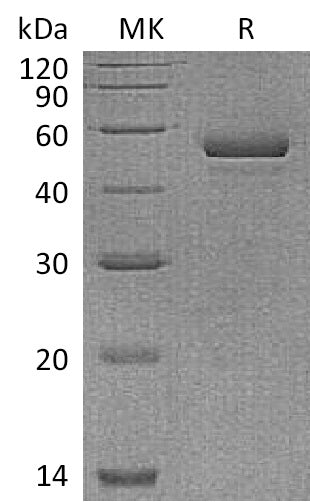 Recombinant Human NPTX1 (C-6His)