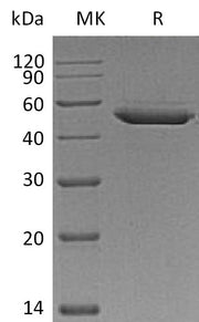 Recombinant Mouse Serpin E2 (C-10His)