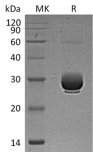 Recombinant Mouse ANGPTL3 (C-6His)