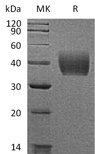 Recombinant Mouse TF (C-6His)