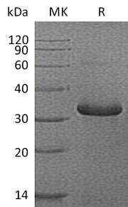 Recombinant Human IGFBP-1 (C-6His)