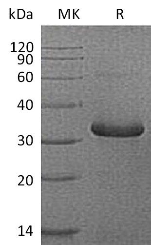 Recombinant Human IGFBP-1 (C-6His)