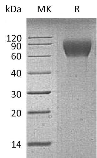 Recombinant Mouse CD6 (C-6His)