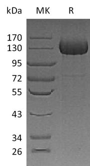 Recombinant Human CDO (C-6His)