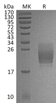 Recombinant Mouse CD160 (C-6His)