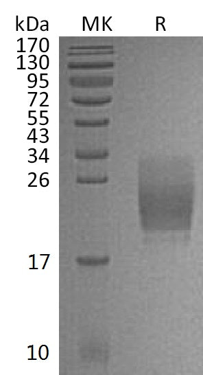 Recombinant Mouse CD160 (C-6His)