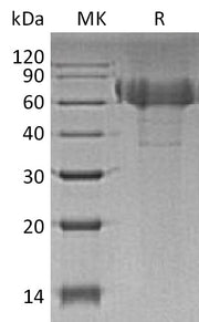 Recombinant Human TIM-4 (C-6His)