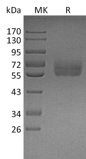 Recombinant Human Dtk (C-6His)