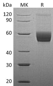 Recombinant Human Serpin A12 (C-10His)