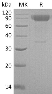 Recombinant Mouse IL-2RG (C-Fc)