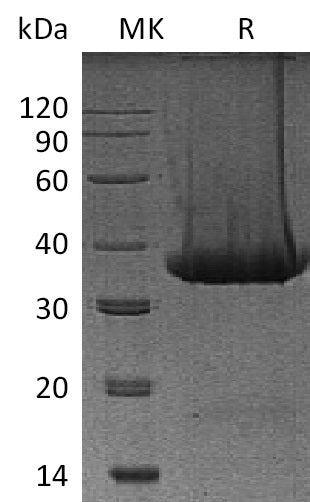 Recombinant Mouse Kallikrein 1 (C-6His)