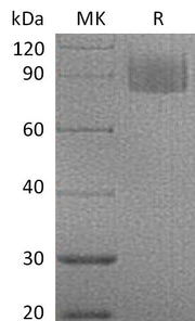 Recombinant Mouse MAG (C-6His)