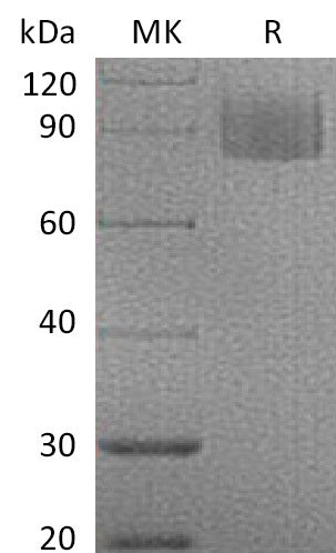 Recombinant Mouse MAG (C-6His)