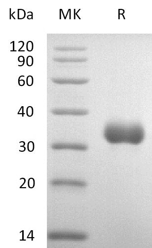Recombinant Human IGFBP-7 (C-6His)